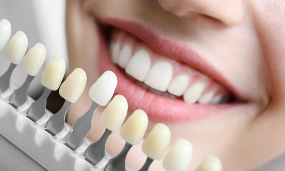 Improve Your Smile Using Cosmetic Dentistry