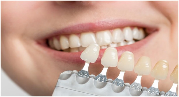 Cosmetic Dental Tips
