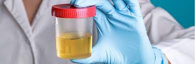 From Risky Business to Foolproof Solution: Synthetic Urine Explained